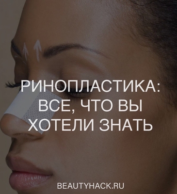 Ринопластика: все, что вы хотели знать