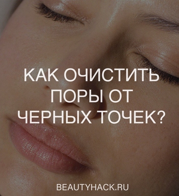 Как очистить поры от черных точек? 5 средств в помощь