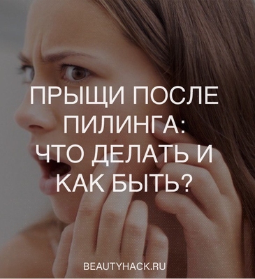 Прыщи после пилинга: что делать и как быть?